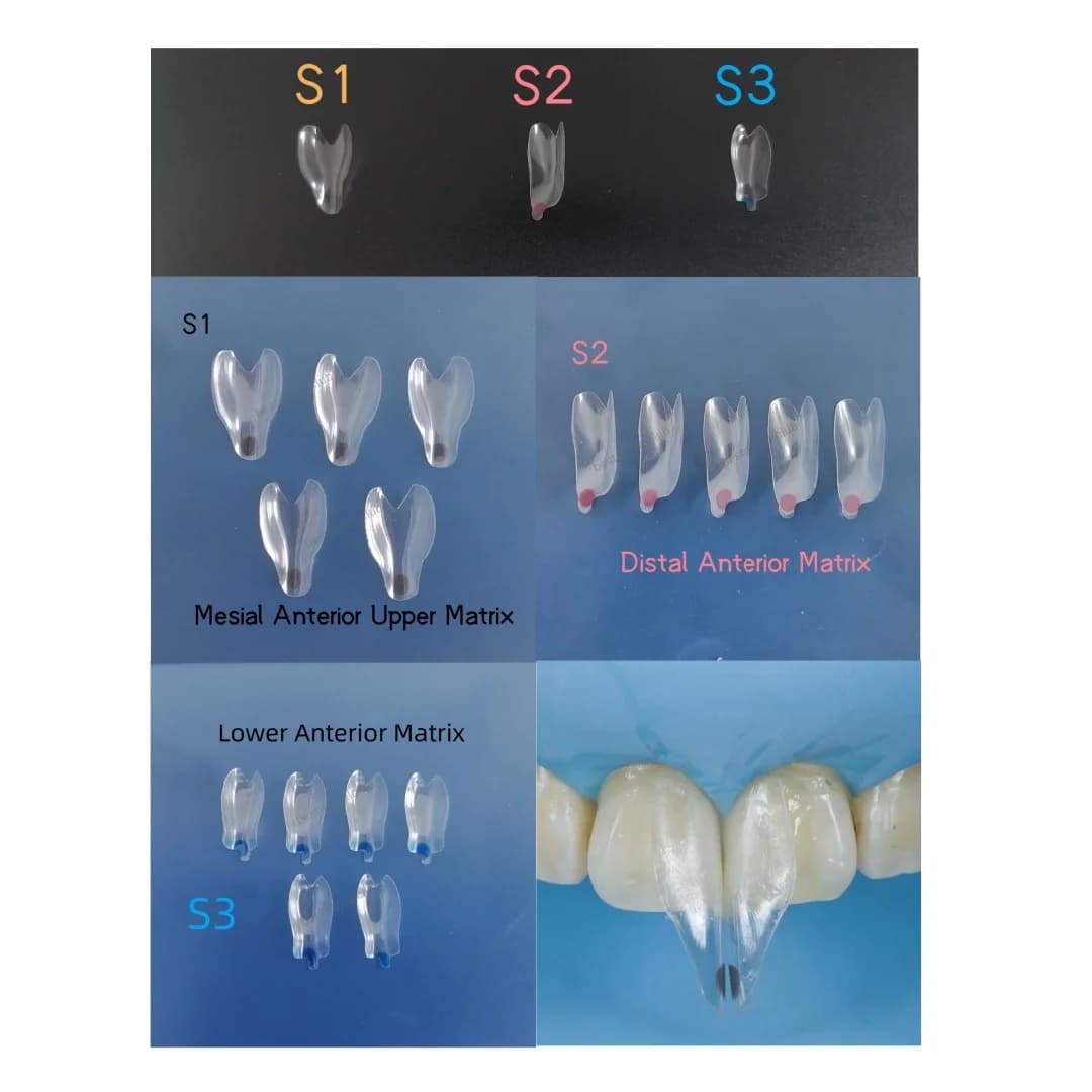 5Pcs Dental Widening Front Tranparent Clear Matrix BT Matrices Fits BioClear S1/2/3